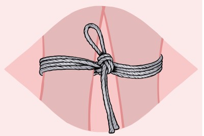 Double Column Tie, shibari, kinbaku, bondage
